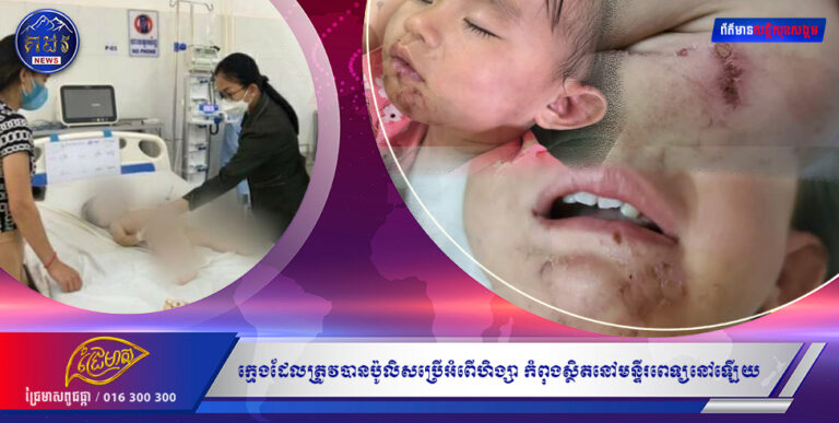 ពិតជាគួរឲ្យស្រណោះខ្លាំងណាស់លោកអើយ ! ក្មេងដែលត្រូវបានប៉ូលិសប្រើអំពើហិង្សា កំពុងស្ថិតនៅមន្ទីរពេទ្យនៅឡើយ