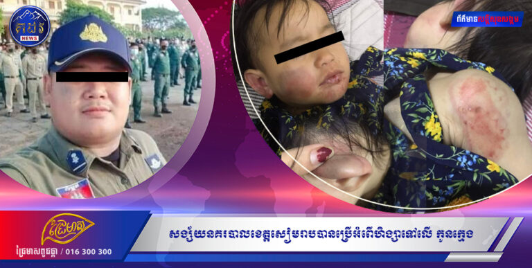 សង្ស័យនគរបាលខេត្តសៀមរាបបានប្រើអំពើហិង្សាទៅលើ កូនក្មេង