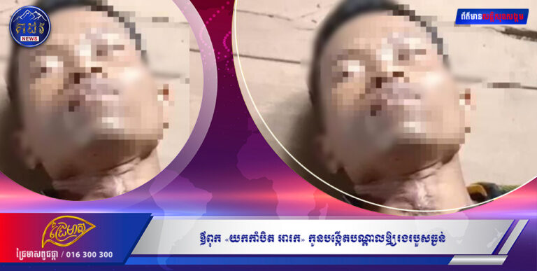 ឪពុក «យកកាំបិត អារក» កូនបង្កើតបណ្ដាលឲ្យរងរបួសធ្ងន់